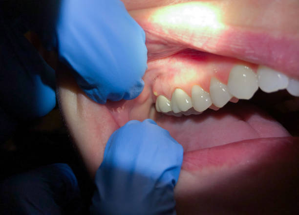 Best Knocked-Out Tooth Emergency  in Fanwood, NJ